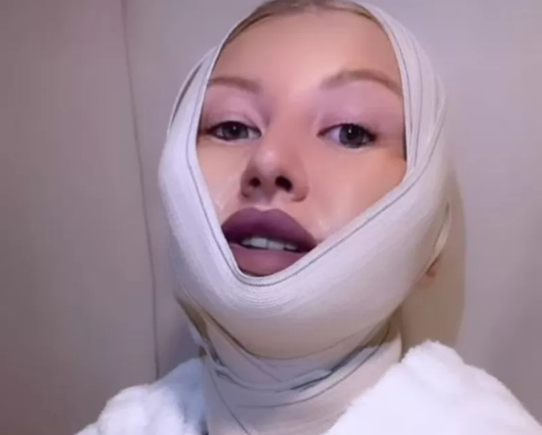 У Марго Овсянниковой раздуло лицо после посещения хирурга Тимура Хайдарова