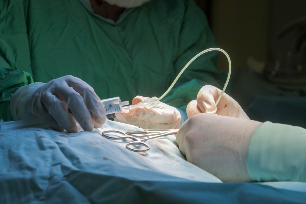 Repubblica: в Италии женщине отрезали грудь и лечили от рака из-за ошибки врачей