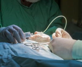 Repubblica: в Италии женщине отрезали грудь и лечили от рака из-за ошибки врачей